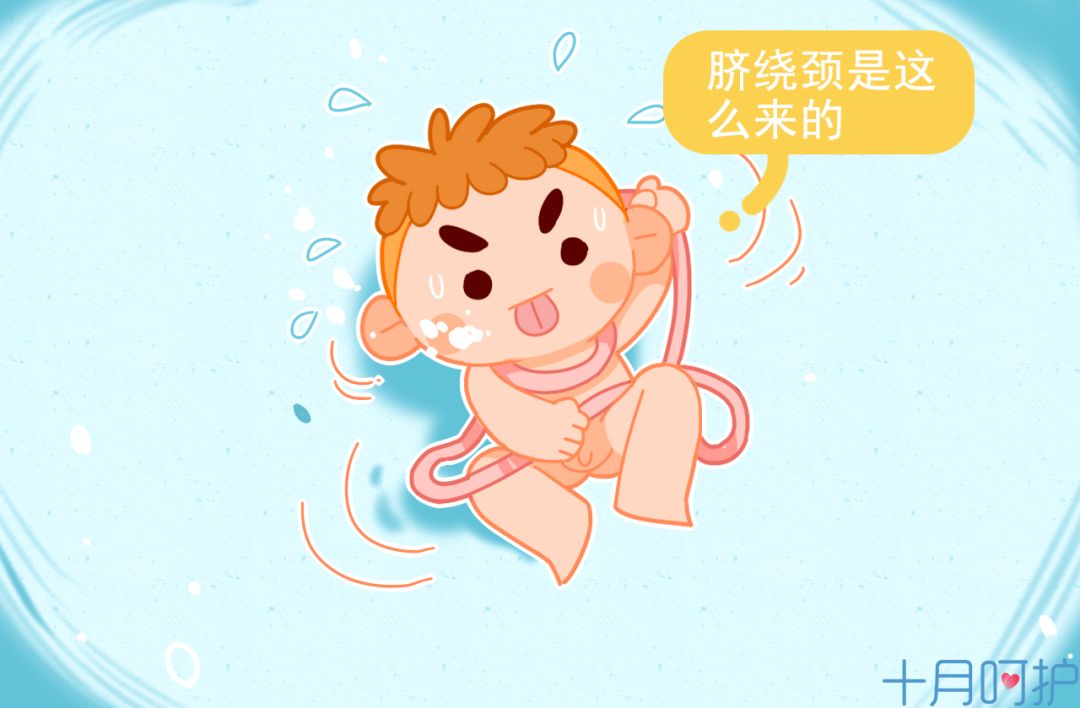 脐带绕颈几圈符合剖腹产指标,头位未入盆脐带绕颈两圈顺还是剖