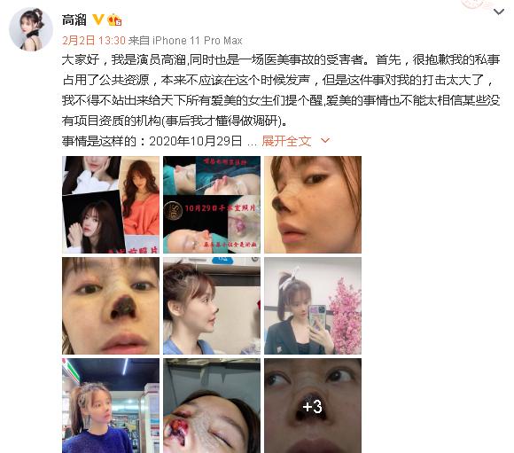 95后整容女演员,高溜整容失败案例