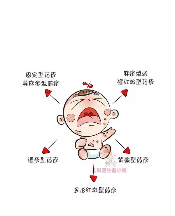 荨麻疹湿疹发病原因及治疗方法,热疹皮疹湿疹有什么区别