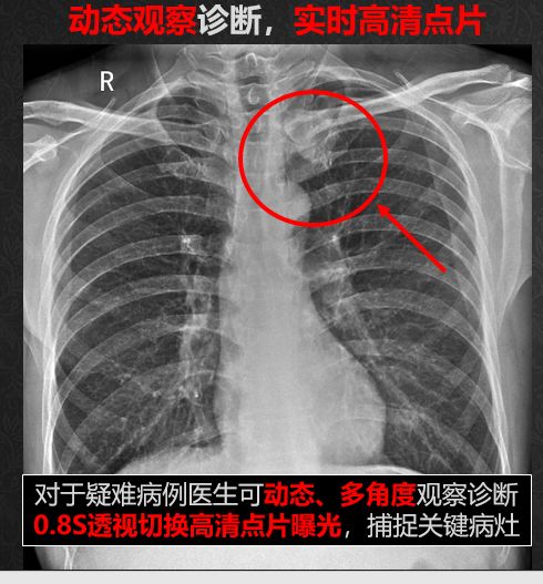 专访ChinaMed上的安健科技——“动态DR不是我们的终点！”