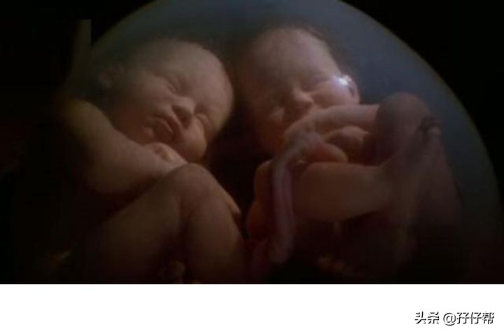 试管双胞胎是不是都是双绒双羊,双绒双羊双胞胎相差5天正常吗