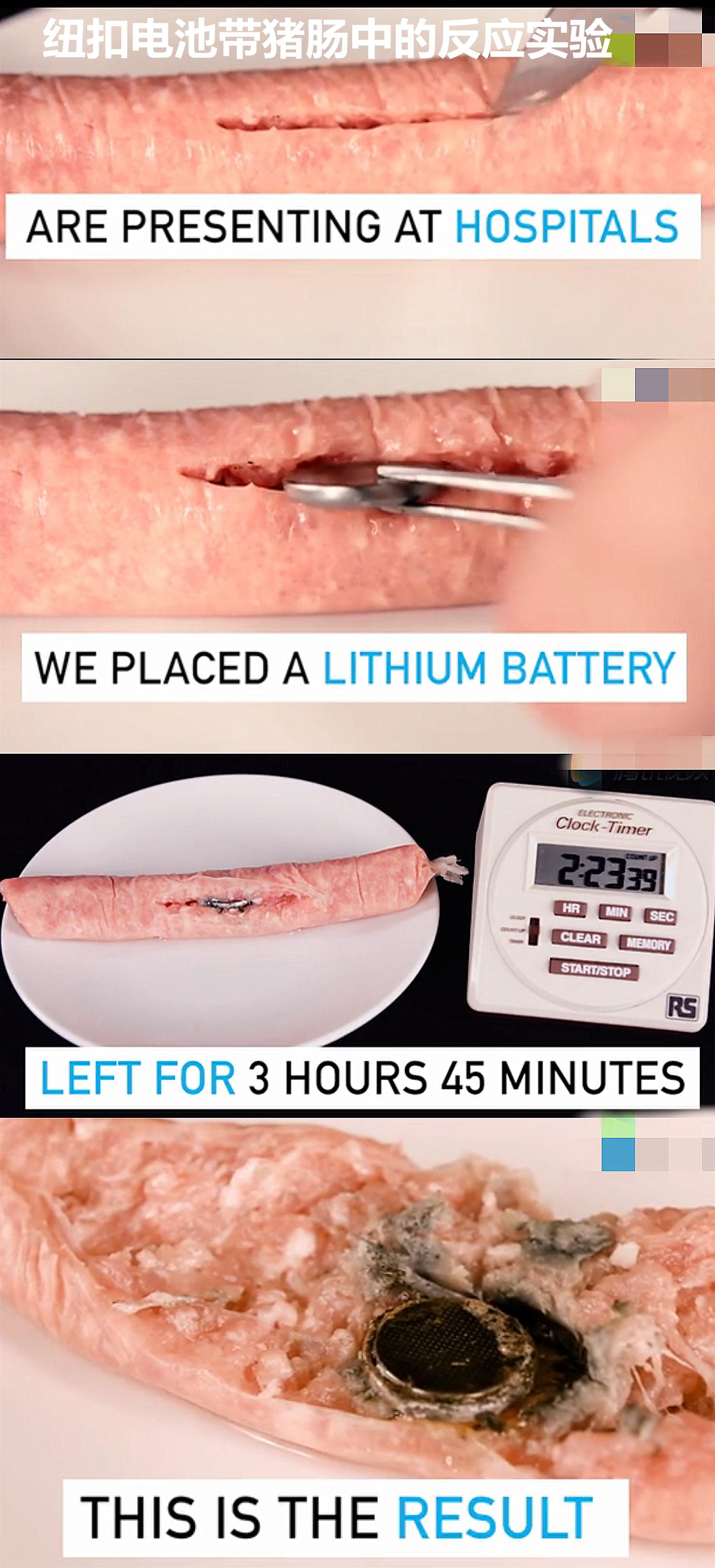 4岁女童误吞一角硬币怎么处理,4岁女童误吞5角硬币