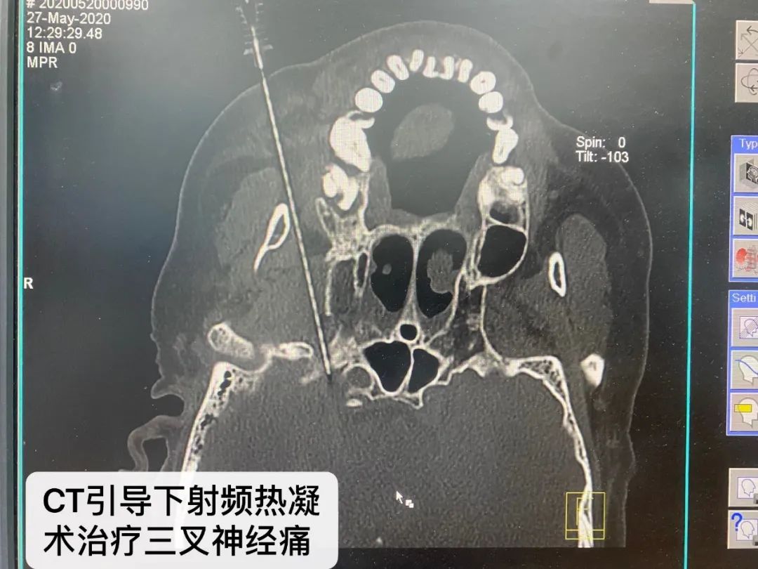顺义妇幼保健院出诊安排,顺义中医院周六日专家门诊