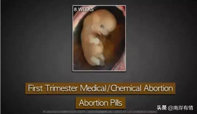 堕胎可怕吗,堕胎到底多可怕