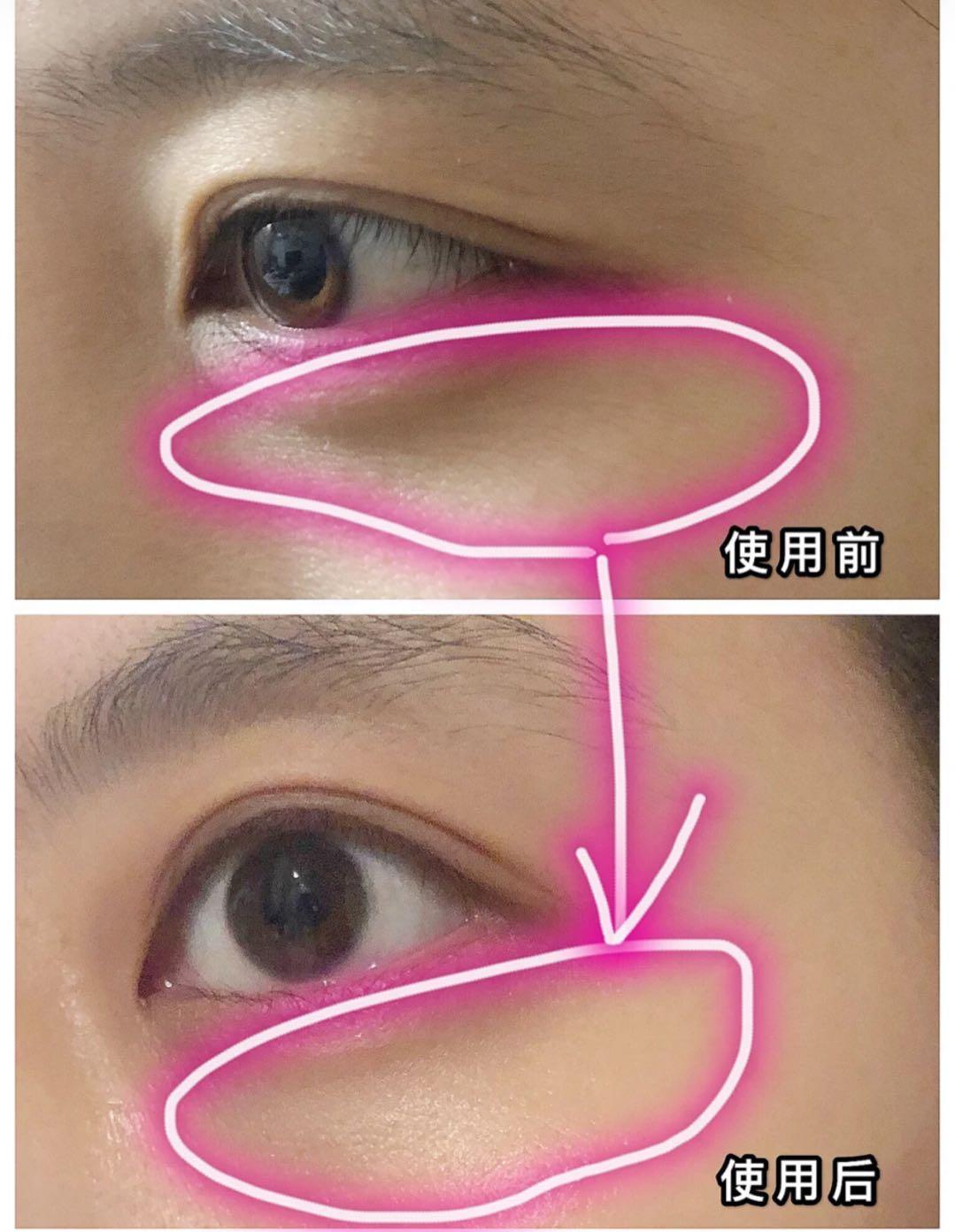 肖战王一博贴眼膜,肖战贴眼膜正确方法