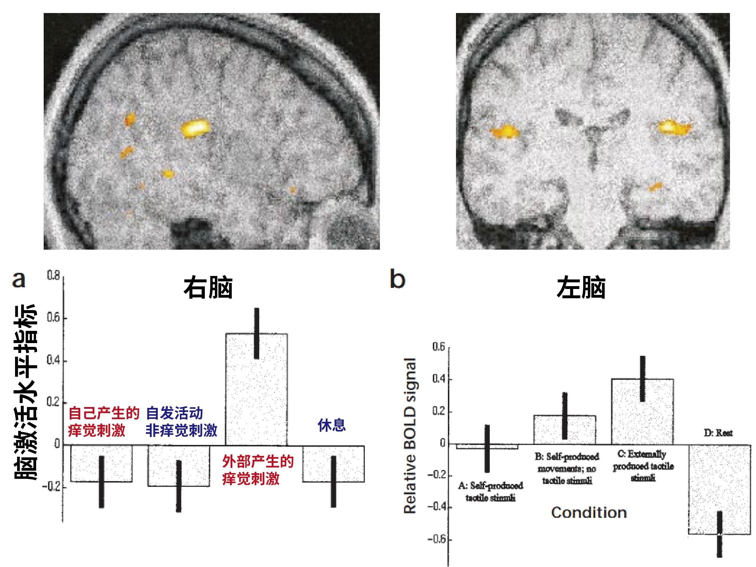 小脑控制身体的功能,小脑控制身体哪些机能
