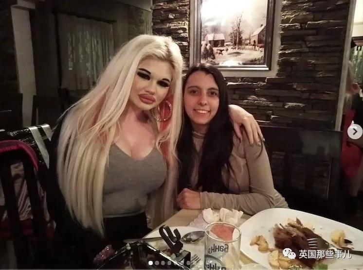 20次整容成功的女人,20次丰唇