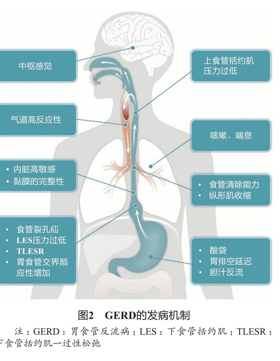 做完胃镜开始咳嗽是怎么回事,咳嗽胸闷ct结果没问题就是难受