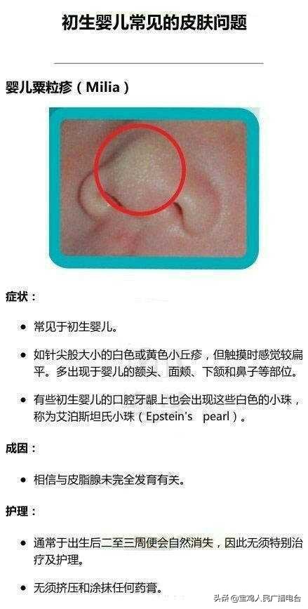 新生儿出现以下情况，都不需要忧虑，宝鸡妇幼名医的这些提示，干货满满！