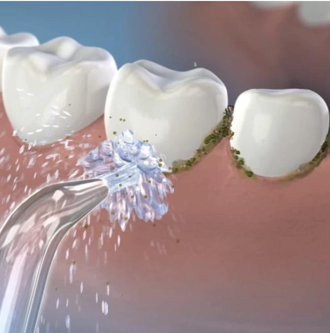 有电动牙刷还要手动刷吗,有了电动牙刷还需要水牙线吗