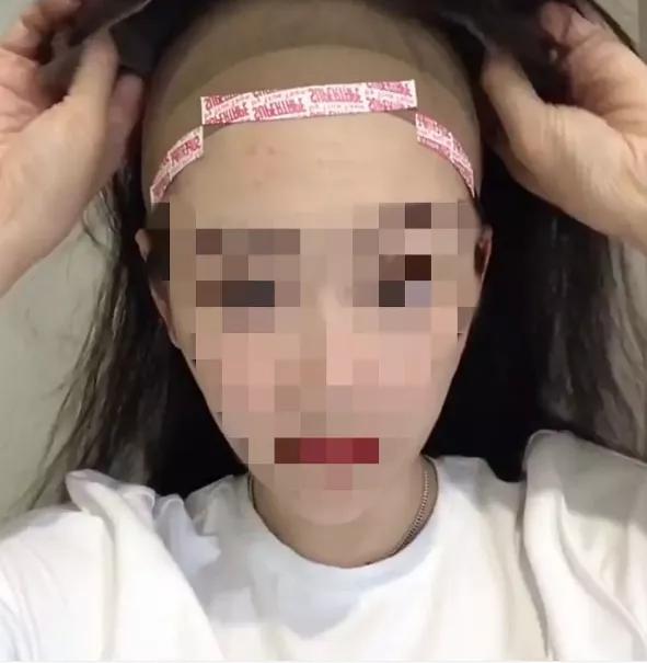 蒋梦婕有脱发困扰,女演员蒋梦婕现状