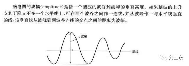 脑电图基础知识入门,脑电图基础知识讲解