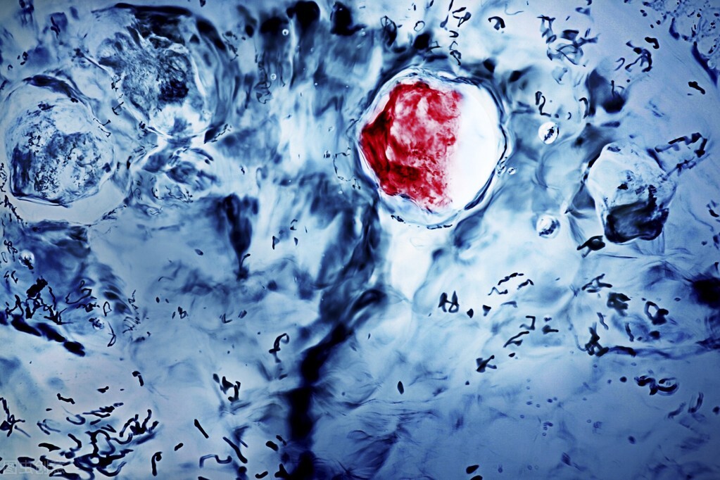 自动饮水机怎么避免滋生细菌,饮水机不清洗长期喝对身体的危害