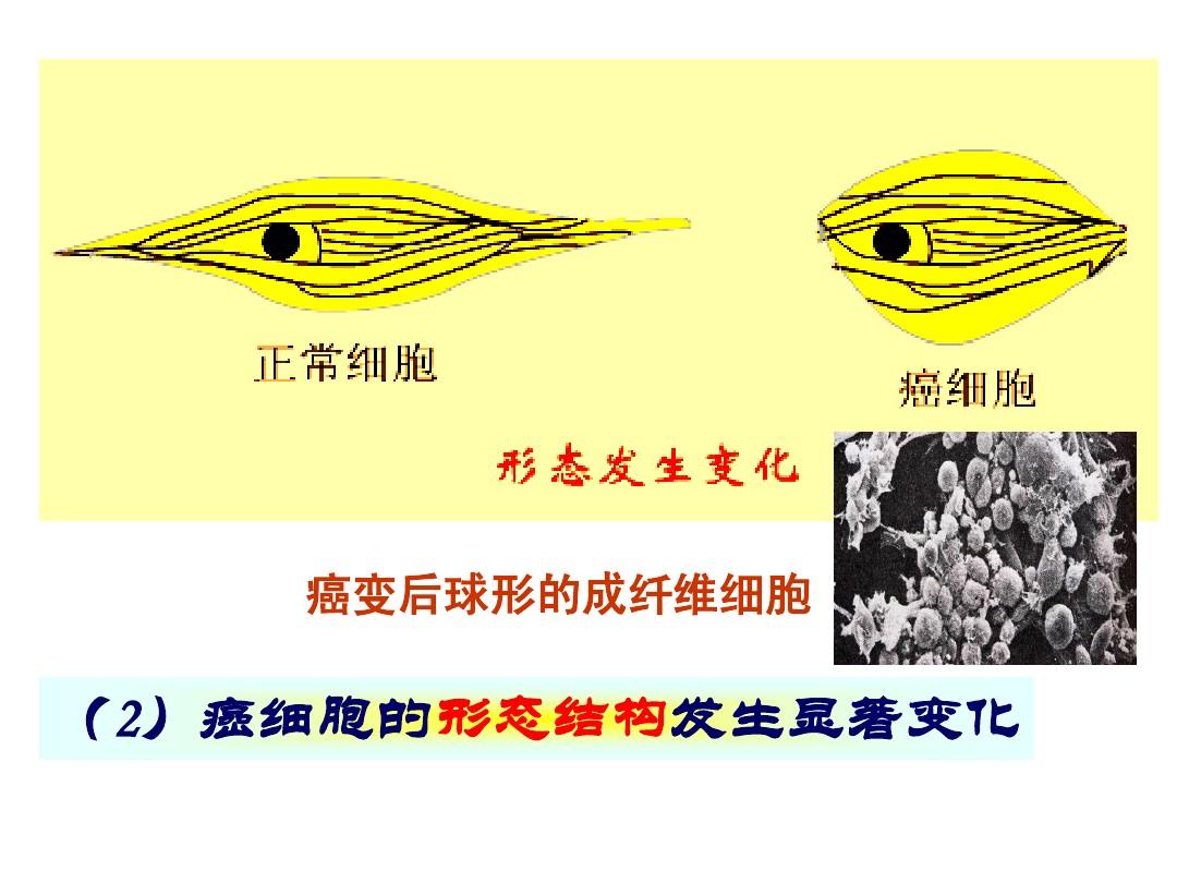 细胞衰老凋亡癌变,细胞的衰老和凋亡图片