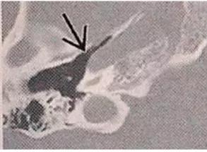 科普文的趣味性,趣味性科普文