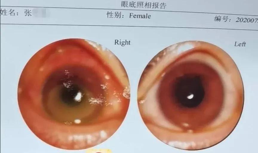 美容店毁容女孩,美容店的毁容事件