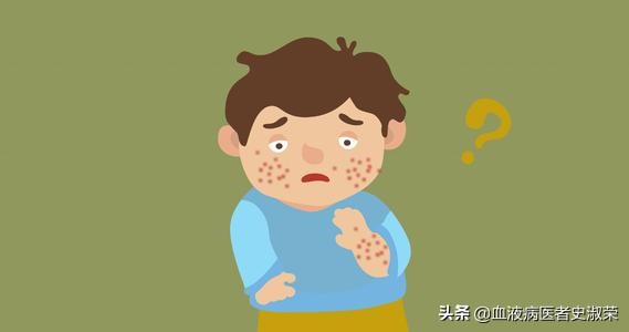 过敏性紫癜是过敏导致的吗？生活中有哪些致病因素？