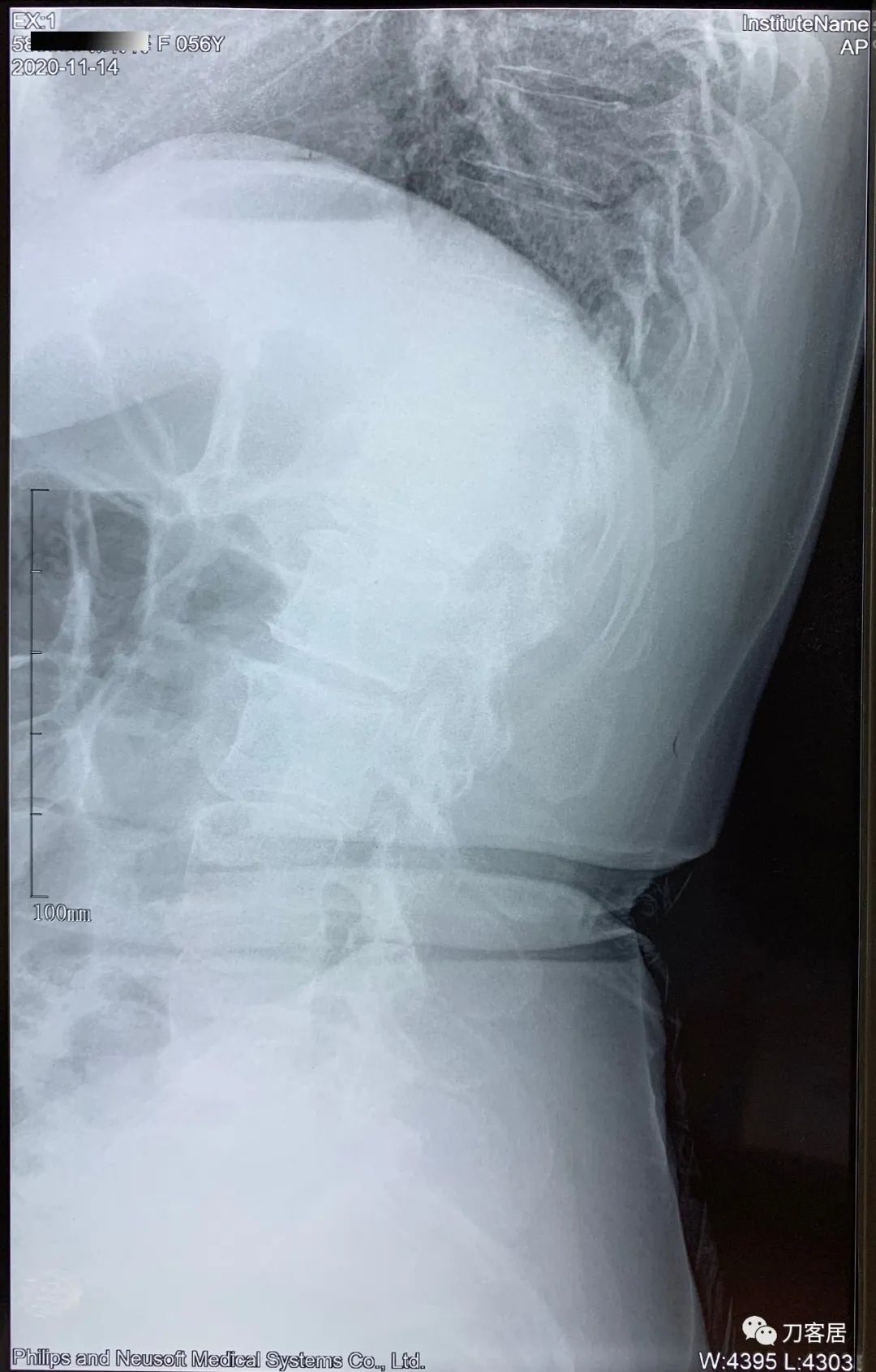 我的门诊病历,我的门诊