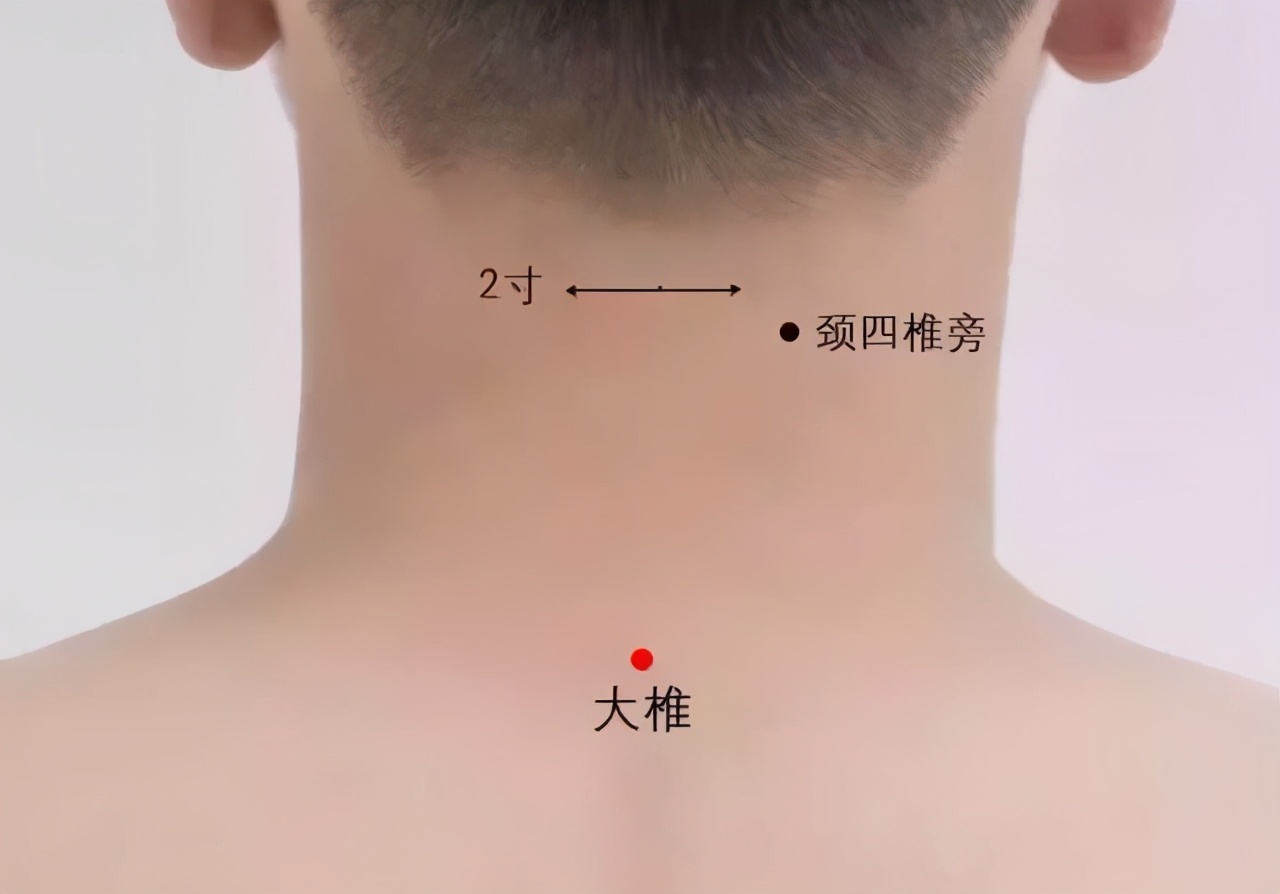 肩颈酸痛的穴位解决方法,缓解肩颈酸痛最有效的运动