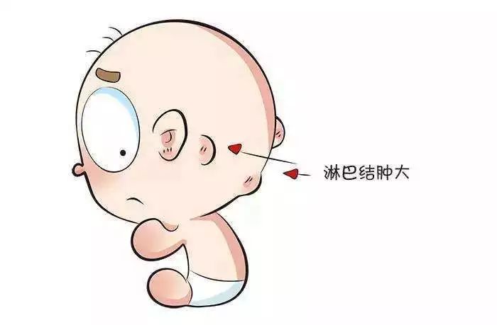 脖子摸到黄豆大小的淋巴结正常吗,脖子侧面摸到黄豆粒大小疙瘩