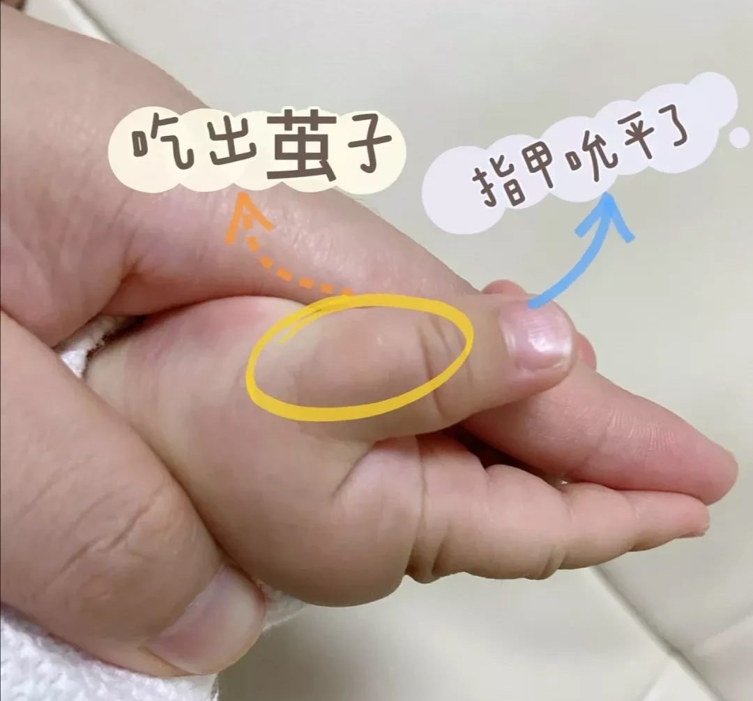 宝宝运动发育迟缓需做哪些康复,宝宝大运动发育迟缓有哪些原因