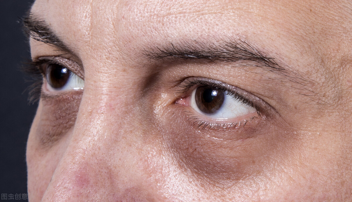 为什么眼袋黑眼圈太重,为什么熬夜会黑眼圈