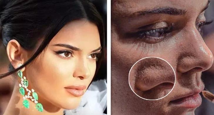 有黑头和没黑头有什么区别,没有长过黑头却长黑头怎么办