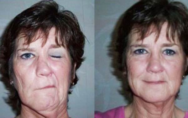 到底是左眼跳财还是右眼跳灾,到底是右眼跳灾还是左眼跳灾