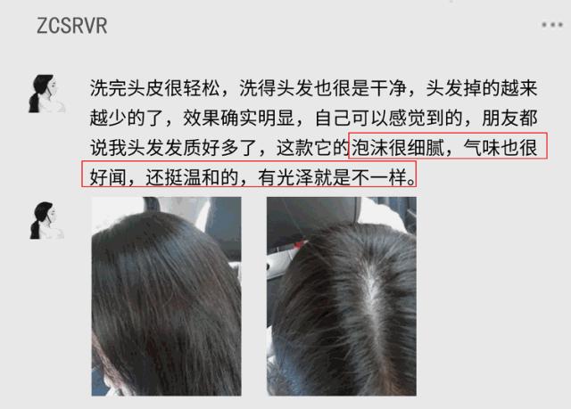 沙宣洗发水为什么头发油油的,沙宣洗发水非常的软塌