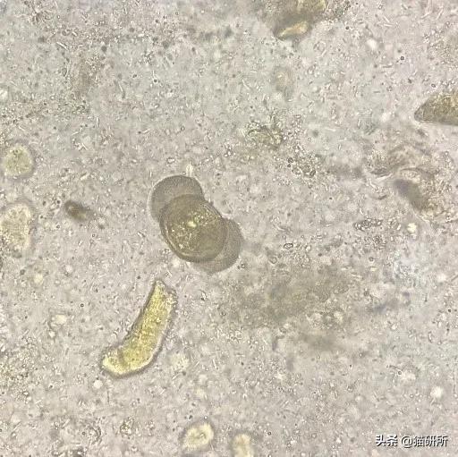 显微镜下的猫屎，竟然和这么多食物都撞脸？