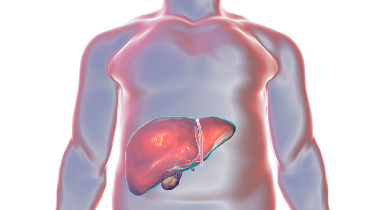 为什么会水肿怎么解决,水肿的原因多样你知道有哪些