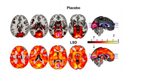 零零后贩卖“邮票”*品毒**LSD？它曾让乔布斯沉迷其中