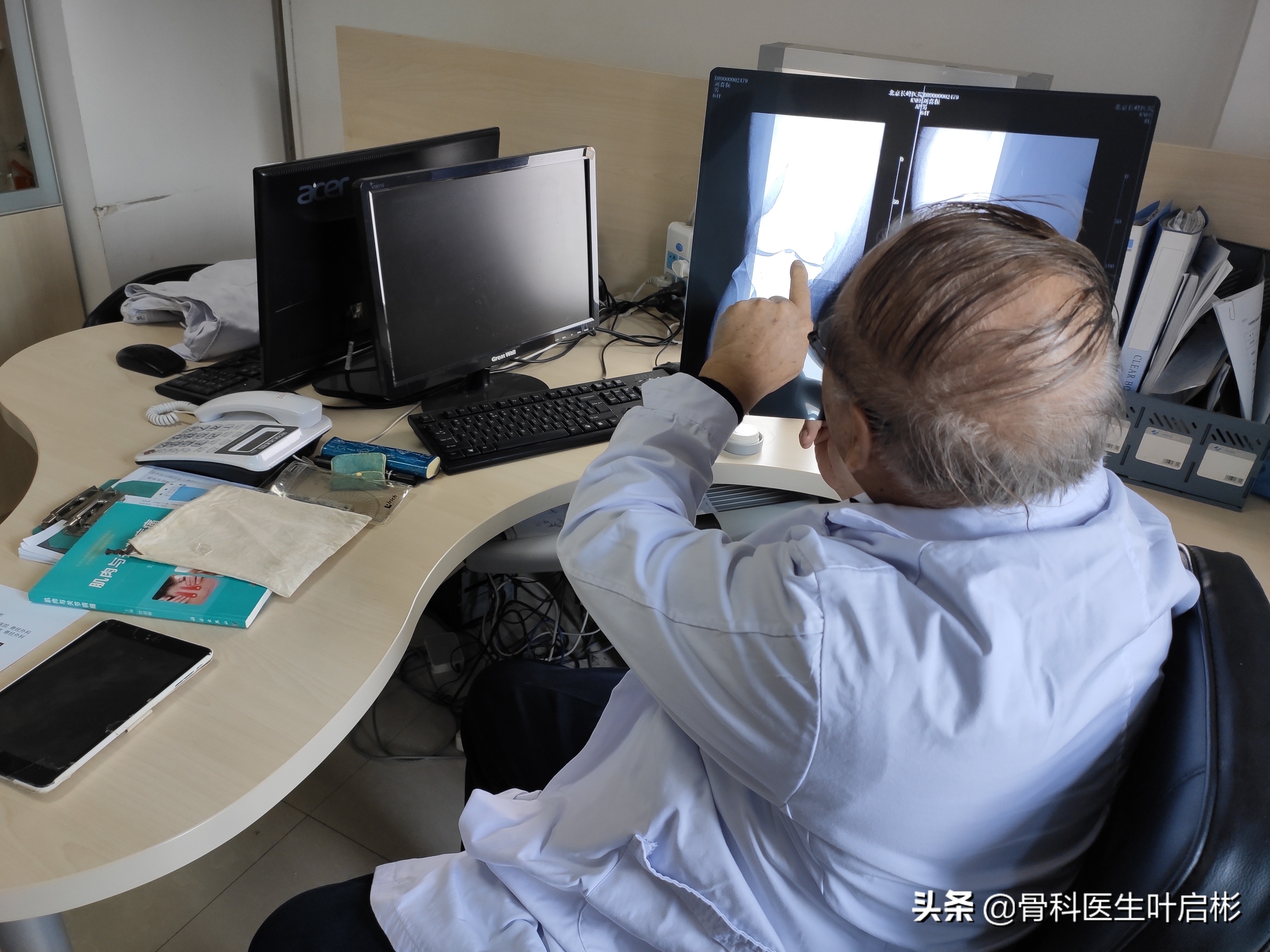 治疗腰背酸痛的养生方法,治疗腰背疼的训练