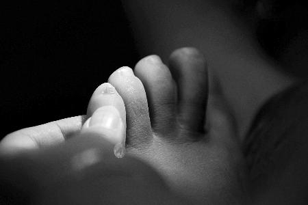 人的小脚指甲为什么是畸形的,小脚趾甲不分瓣的是什么种族