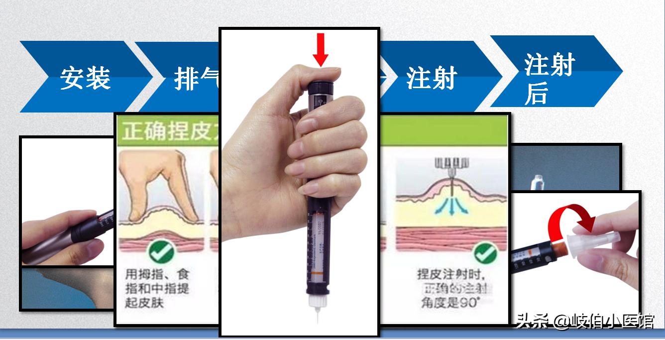 胰岛素怎样注射及剂量,常用胰岛素的注射部位及注意事项