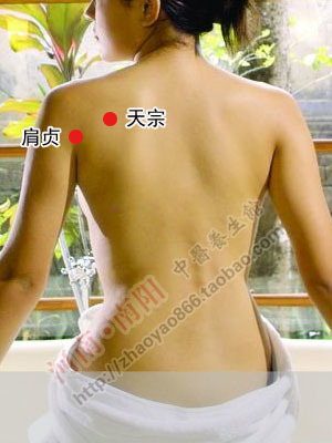 肩周炎艾灸后加重是怎么回事,肩周炎拔罐放血后还能艾灸吗