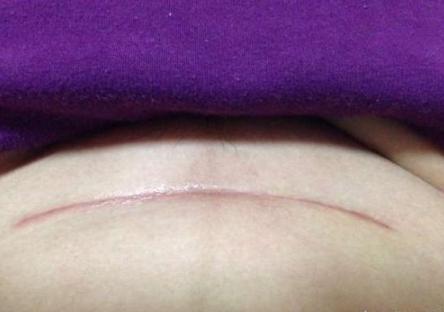 坐月子最容易落下病根的3大误区,专家产后坐月子请记住这八条