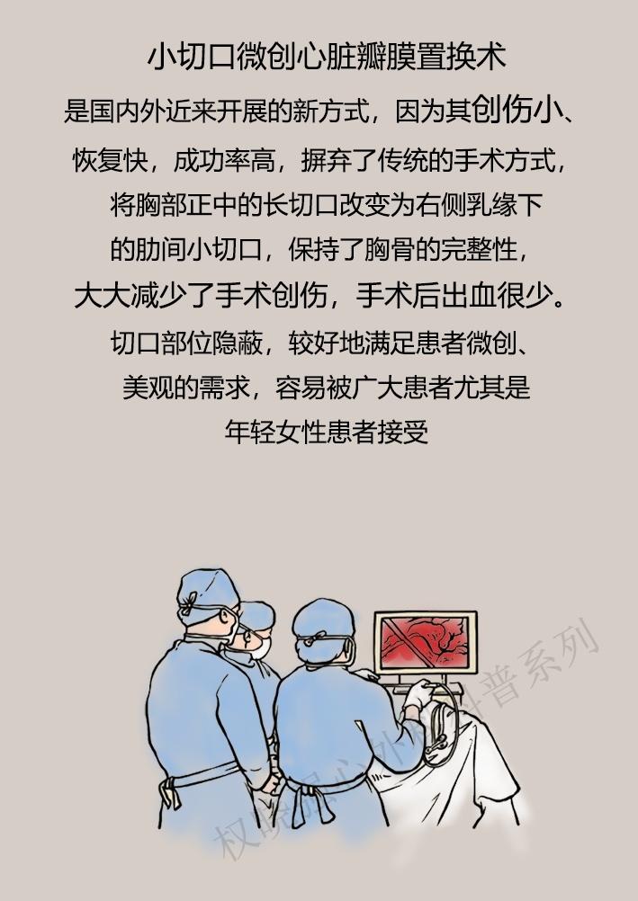 心脏二尖瓣狭窄怎么治疗,二尖瓣狭窄重度能活多久