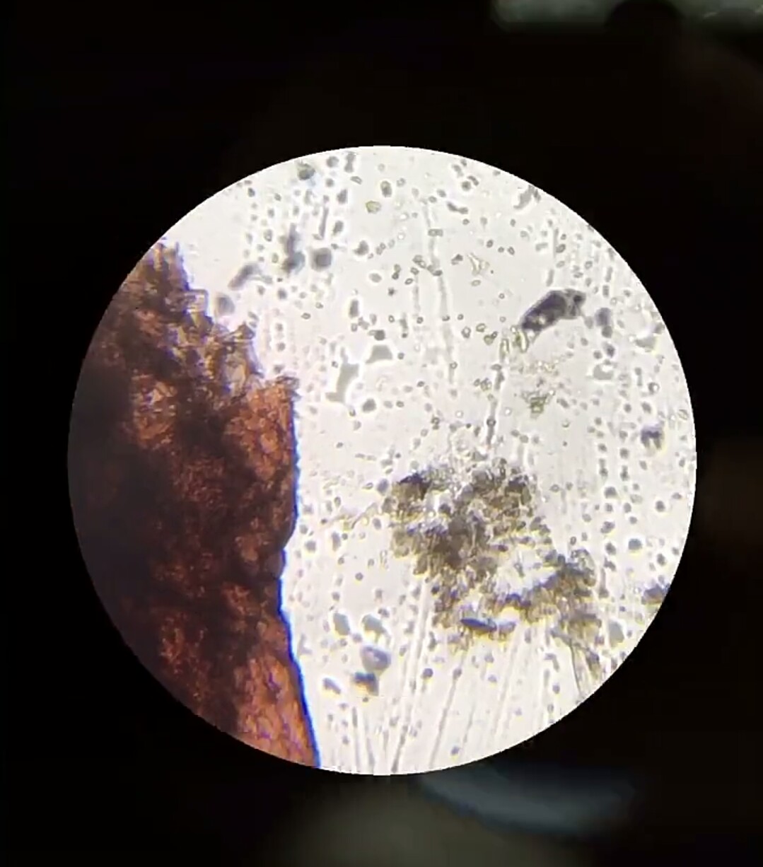 杨梅有农药味道怎么洗,杨梅里面的虫子真的能洗干净吗