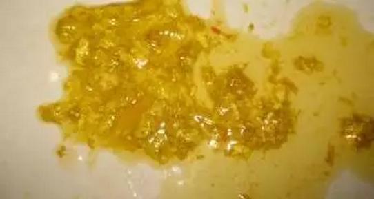 秋季腹泻如何观察及护理,11月宝宝秋季腹泻为什么就发烧