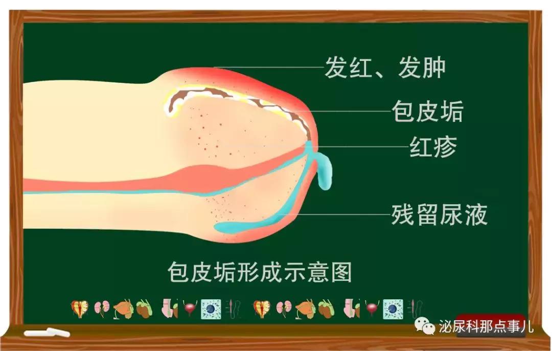 「科普」丁丁皮下有了硬块是怎么回事？