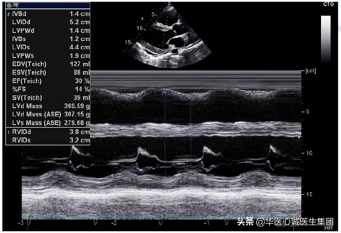 杨颖局部图,杨颖早期下颌宽大