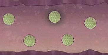 慌了,做个检查发现感染HPV,一定会得宫颈癌么?