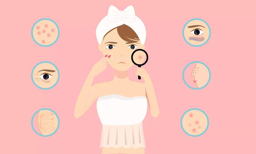 甲硝唑凝胶去草莓鼻黑头方法,甲硝唑凝胶草莓鼻可以用吗