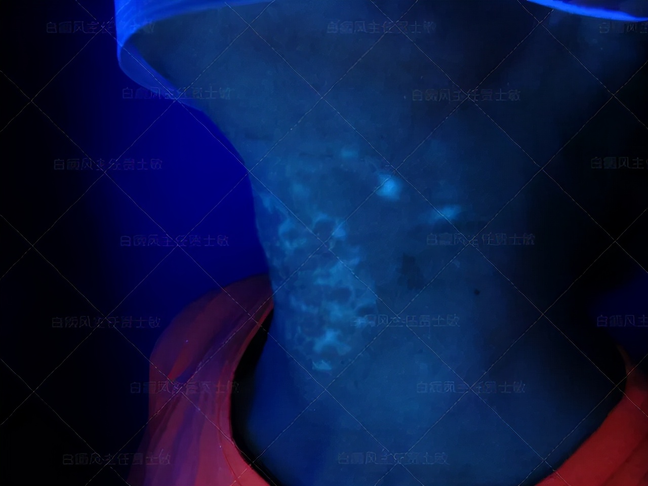 18岁男孩高考备战,18岁男孩白斑