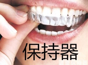 矫正科普15秒,关于早期矫正的科普