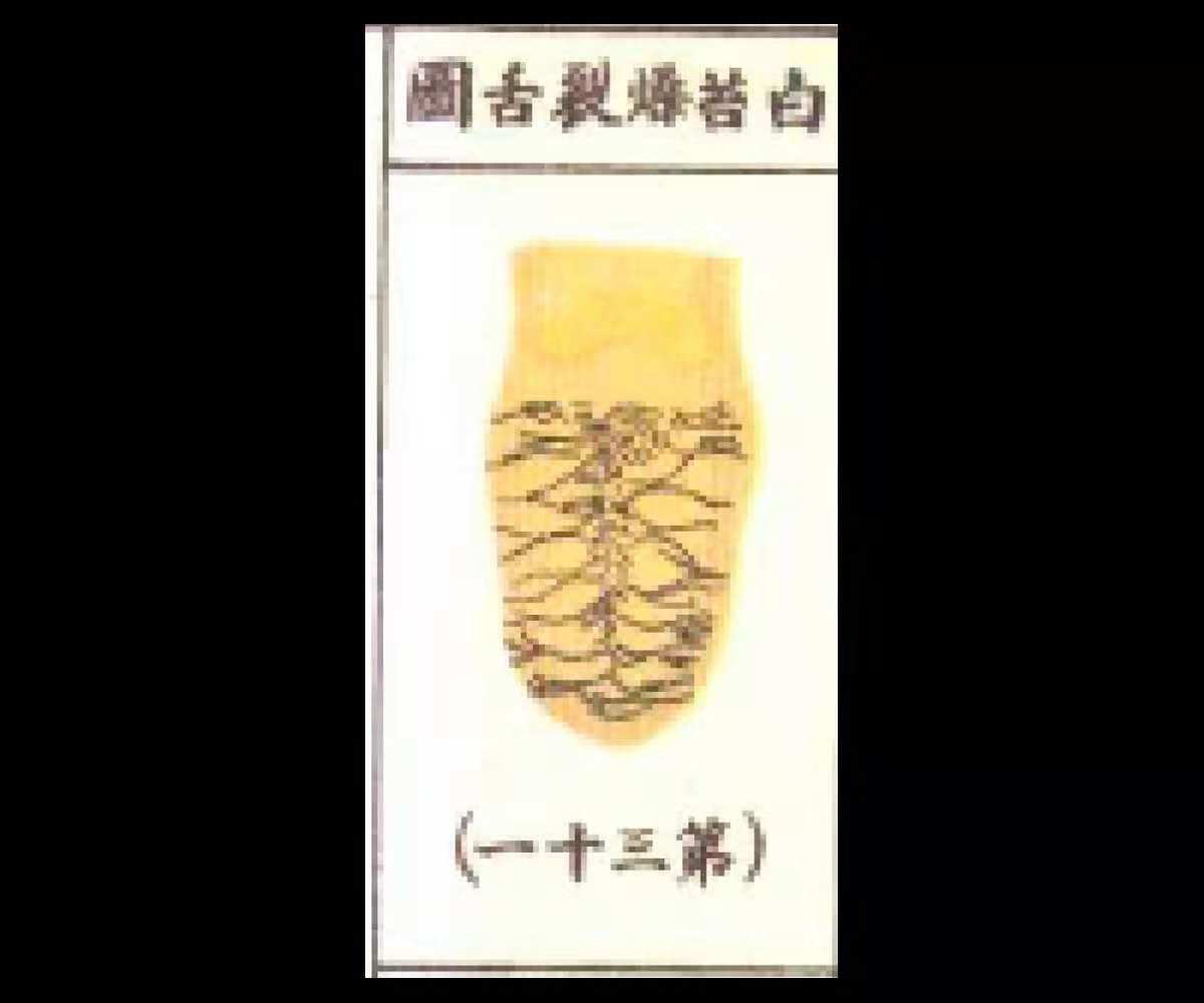 舌红苔燥中医辨证,血虚舌裂纹白苔