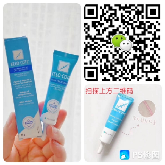 你用过最好的祛疤方法,小红书推荐祛疤真的有效吗