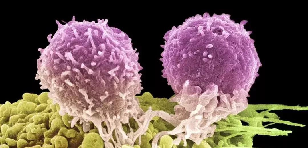科学家找到了癌细胞的软肋，给了它致命的最后一击！