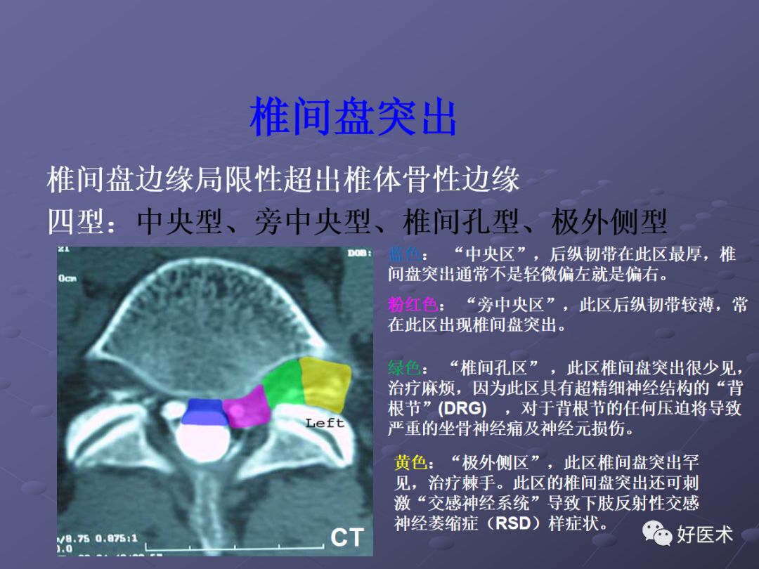 脊柱mri有哪些特点,乳腺疾病的mri诊断及鉴别